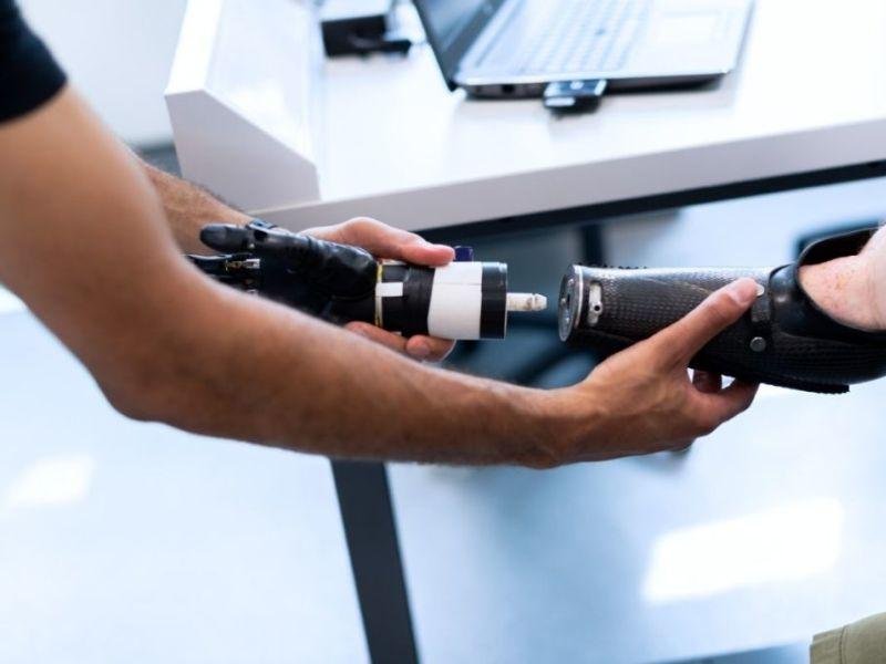 Understanding Upper Extremity Prosthetics: A Simple Guide