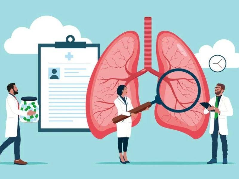 All You Need To Know About Lung Cancer Treatments