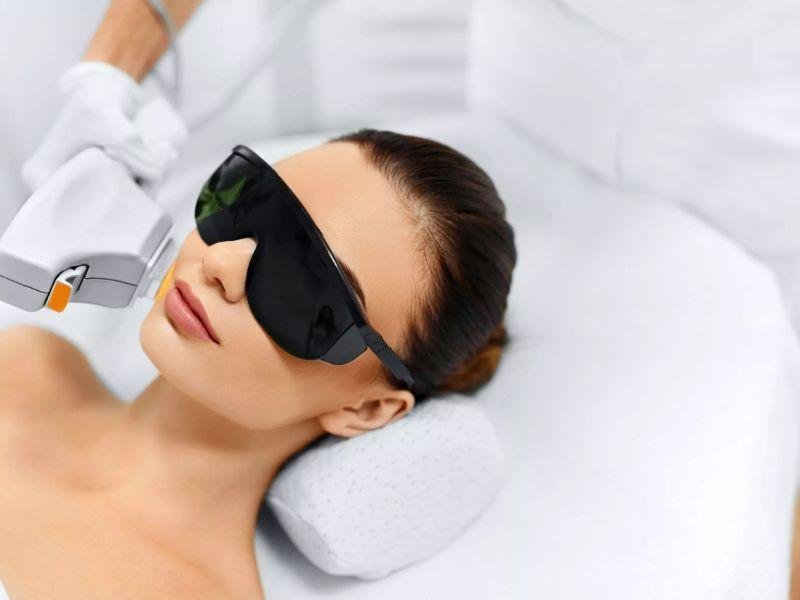 A Guide to Laser Skin Rejuvenation